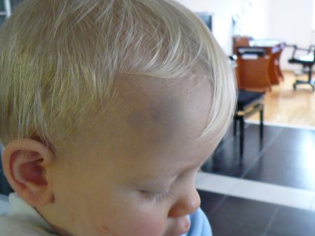 Premier voyage aux urgences....